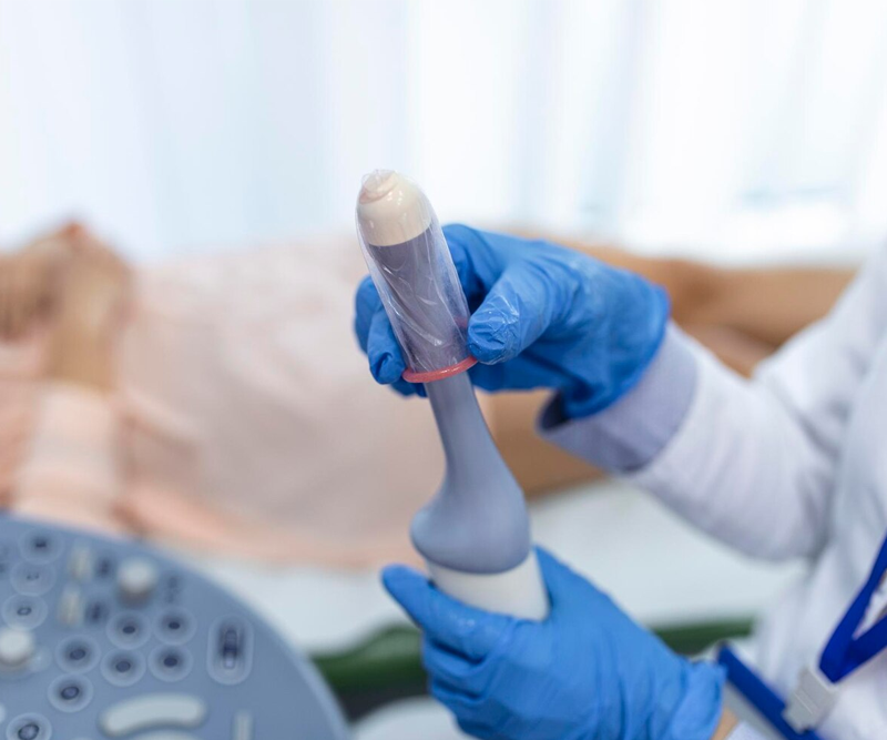 Gynaecology scan & short consultation